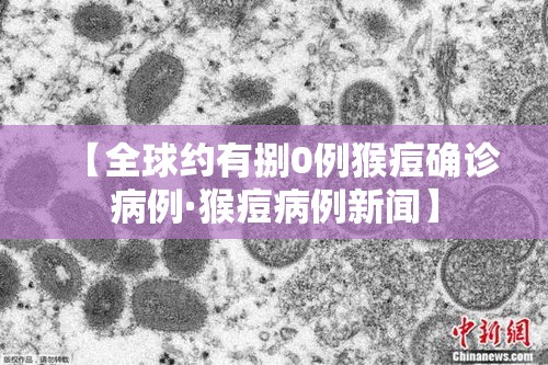 【全球约有捌0例猴痘确诊病例·猴痘病例新闻】 【全球约有捌0例猴痘确诊病例·猴痘病例新闻】