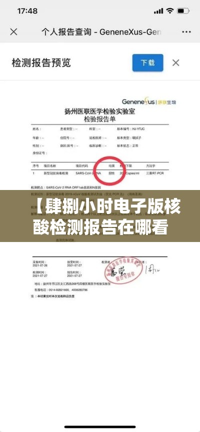 【肆捌小时电子版核酸检测报告在哪看,核酸检测报告电子版怎么查】 【肆捌小时电子版核酸检测报告在哪看,核酸检测报告电子版怎么查】