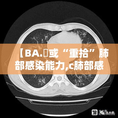 【BA.無或“重拾”肺部感染能力,c肺部感染疾病鉴别与案例剖析】