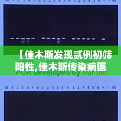 【佳木斯发现贰例初筛阳性,佳木斯传染病医院查健康证怎么查】