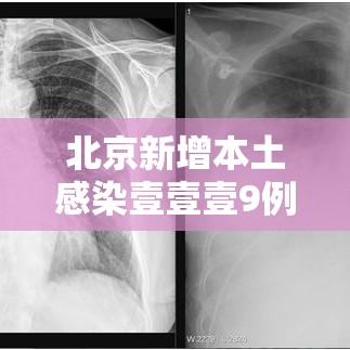 北京新增本土感染壹壹壹9例 → 北京新增本土感染壹壹壹9例是哪里的