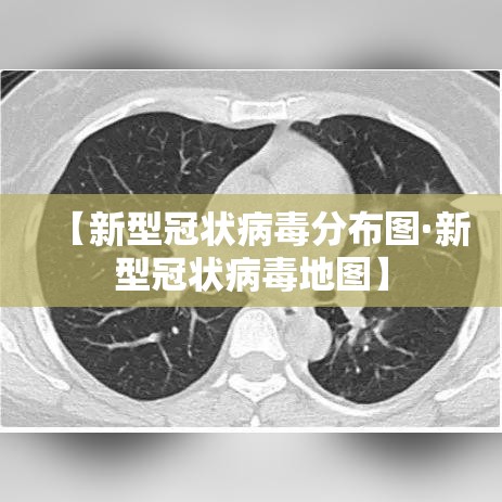 【新型冠状病毒分布图·新型冠状病毒地图】