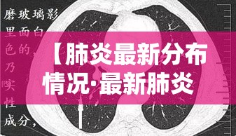 【肺炎最新分布情况·最新肺炎症状】 【肺炎最新分布情况·最新肺炎症状】
