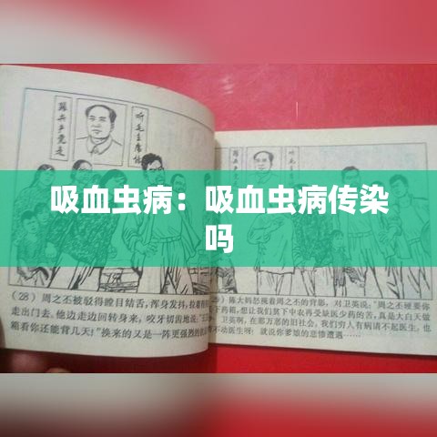 吸血虫病：吸血虫病传染吗